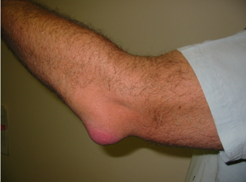 Water on the elbow – Tech Word News