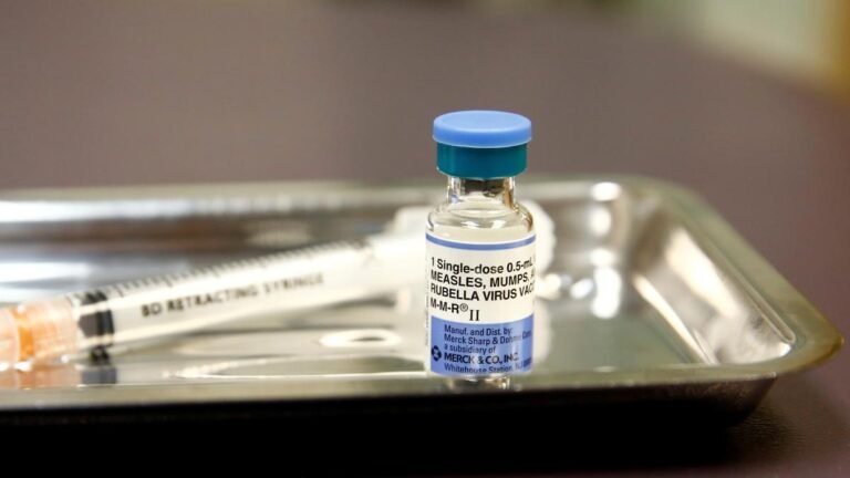 Measles: Incidence of decline in Karnataka but BBMP and Ballari pockets record a higher number of cases