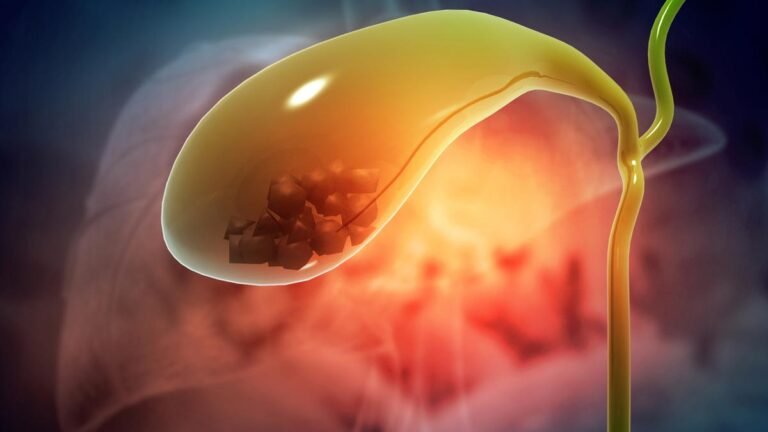Toxic bile stones of the fuel crisis of the gallbladder cancer in Assam, says the study