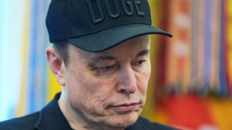 The black spot near the eye of Elon Muska increases speculation in the middle of drug use, Tesla CEO says: “I was not…” | The news today