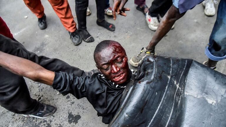 400 injured, 8 deaths reported during the ongoing Kenya Protests, here are several shocking details | Tech Word News
