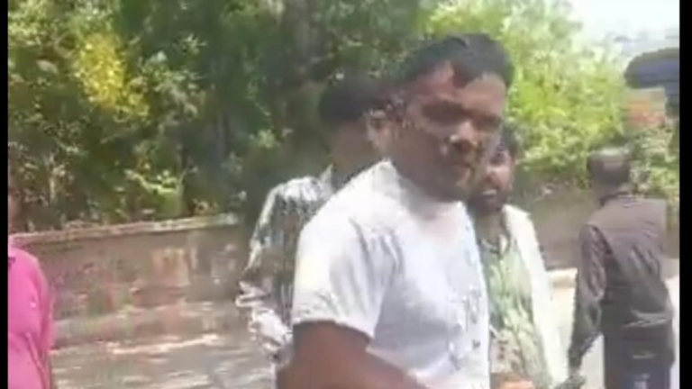 Air India Flying Crash: The only surviving Vishwash Kumar Ramesh video leaving the accident site goes viral | Watch | Tech Word News