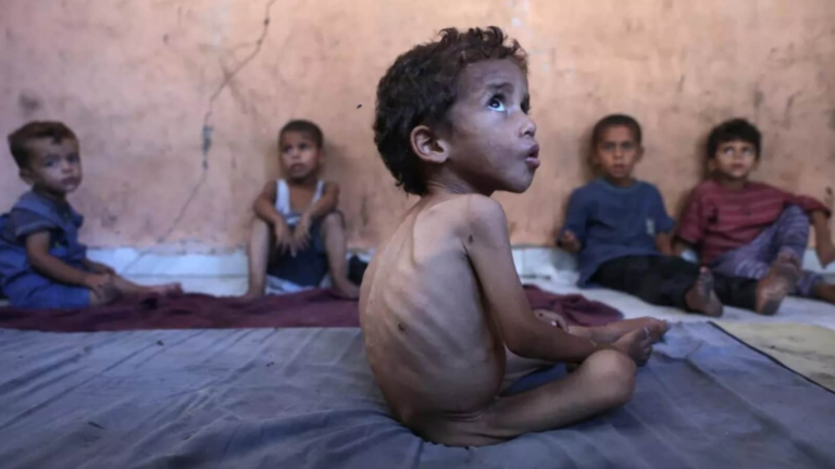 Hunger to grasp the war -torn Gaza: About 2 million are now uncertain, “skeletal children fill the hospital department” | Tech Word News