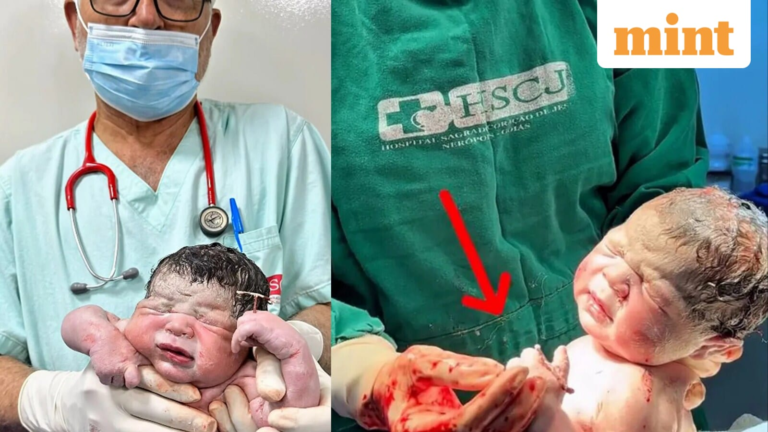 Brazilian child holds a contraceptive coil to prevent it from birth – see Figure | Tech Word News