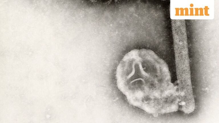 US resident infected with rare H5N5 bird flu, health experts say: “No one really knows…” | Today’s news