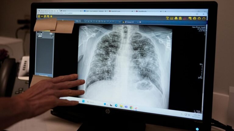 A webinar on air quality and its impact on lung health will be held on November 23