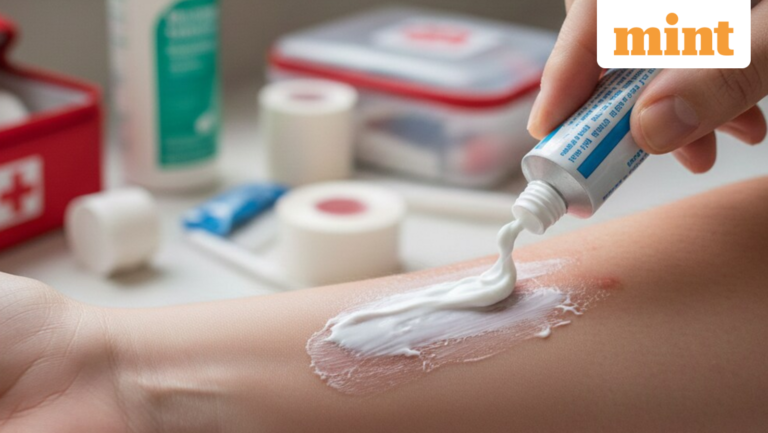 No ice, no toothpaste: Government introduces evidence-based burn treatment protocols | Today’s news