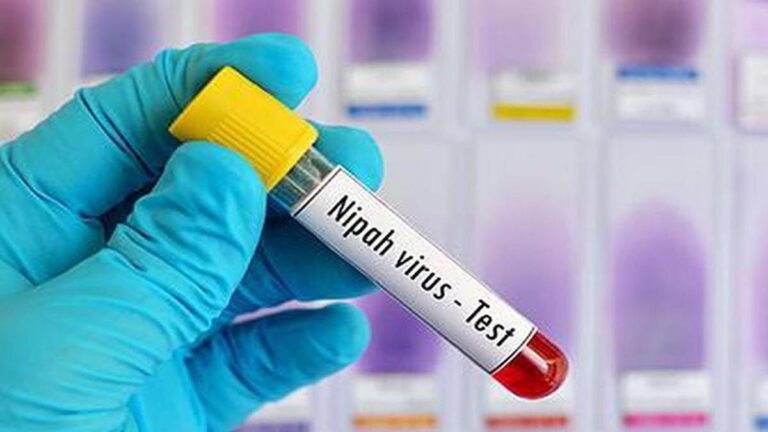 Nipah virus: Two patients with suspected infection in Bengal remain in critical condition
