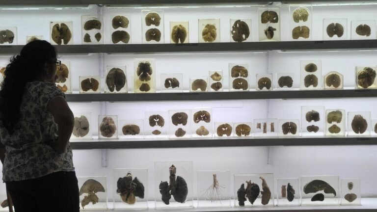 IISc Center for Brain Research launches ₹2 crore AI challenge for early detection of cognitive decline