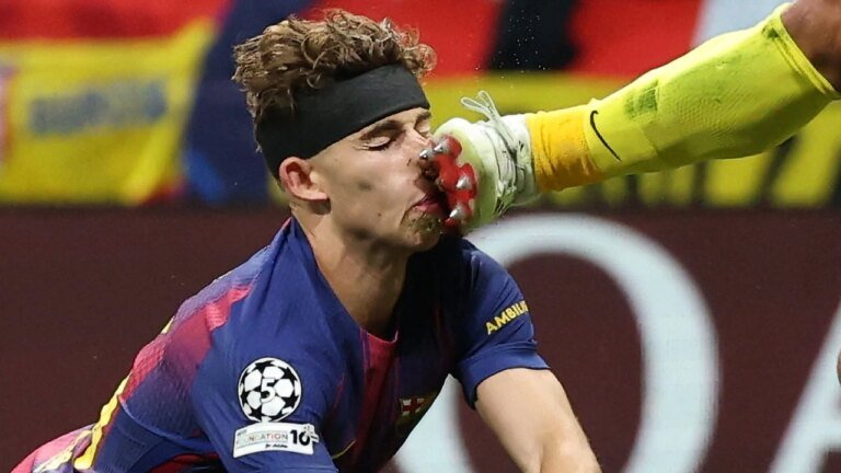 Barcelona vs Atletico Madrid: Fermin Lopez suffered a horrific injury in the quarter-finals