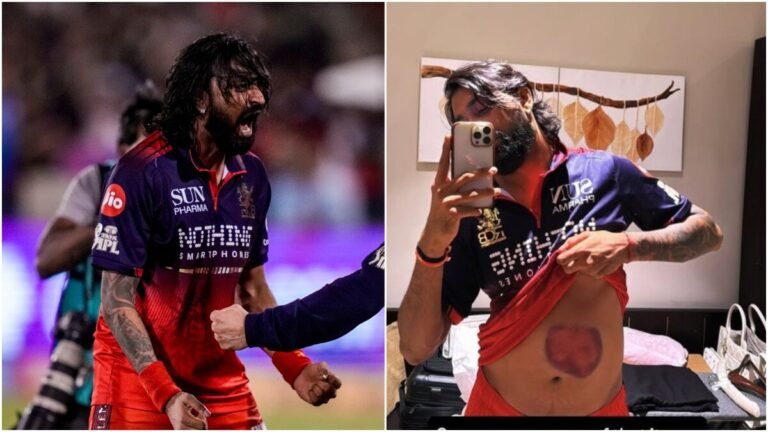 Krunal Pandya shares photo of bruised stomach after heroic knock against MI in Raipur