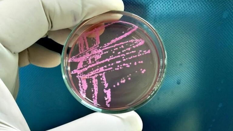 85 confirmed cases of shigellosis reported till June in Kerala; preventive measures initiated