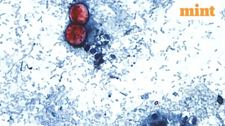Cyclospora is spreading in 34 US states: Why are cases increasing and what foods are under investigation? | Today’s news