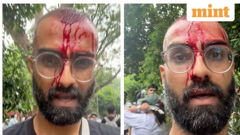 ‘I never thought my face would be exposed like this’: Ramit Verma aka PeeingHuman injured during CJP protest | Today’s news