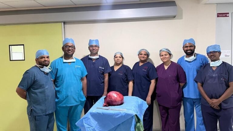 Hyderabad doctors saved a woman with a rare complication of a giant uterine fibroid