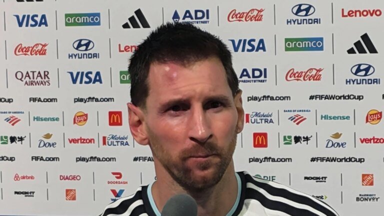 Cape Verde defenders leave Lionel Messi with a bruised head. Pose for photos after the game
