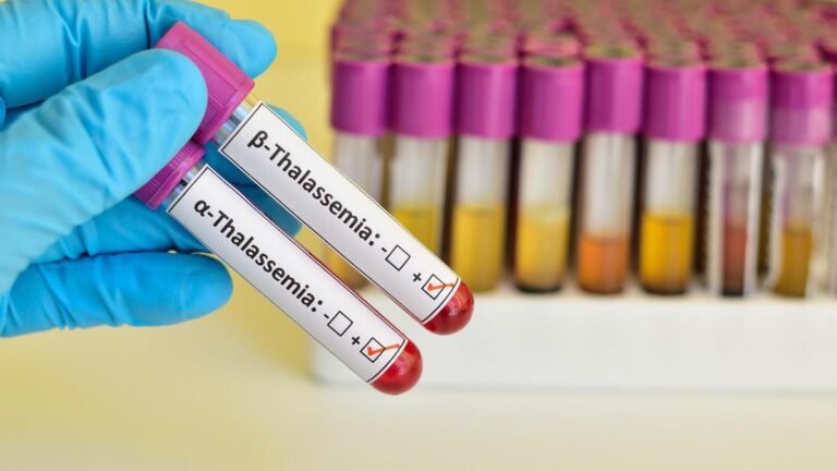 1000 transplants and new beginnings: Thalassemia patients get a second chance